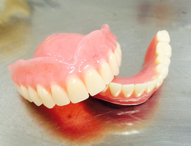 Какие существуют виды акриловых зубных протезов?