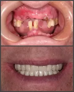 Фотография Реавиз 4