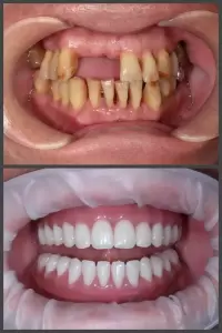 Фотография Реавиз 5